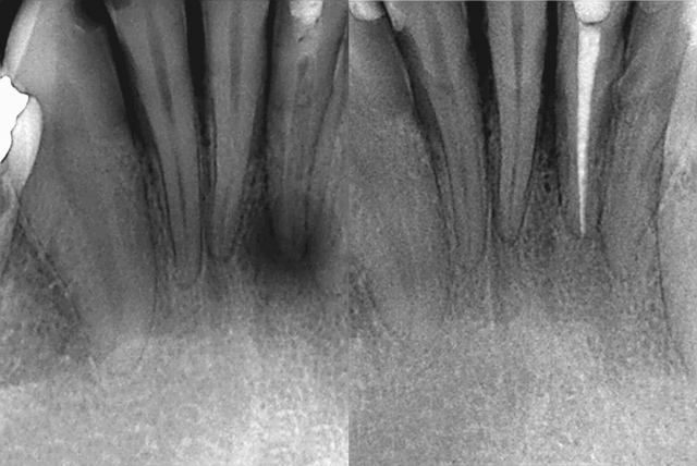 Endodontics